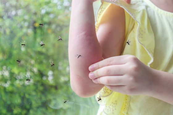 Mujer rascandose el brazo y preocupada por no tener un seguro médico para la temporada de mosquito en LA